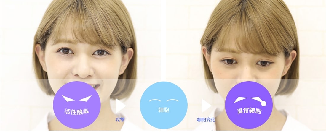 悪玉活性酸素の説明画像